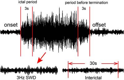 Multifrequency Dynamics of Cortical Neuromagnetic Activity Underlying Seizure Termination in Absence Epilepsy